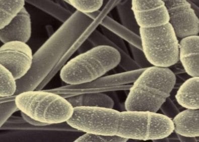 Streptococcus Mutans - Bacteria presente en las caries